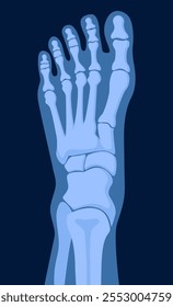 X ray human foot. X-ray picture or radiographic monitor image of metatarsus bones and toes. Medical radiology.