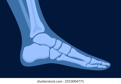 X ray human foot. X-ray picture or radiographic monitor image of metatarsus bones and toes. Medical radiology.