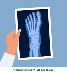 X ray human foot. X-ray picture or radiographic monitor image of metatarsus bones and toes. Medical radiology. Roentgen shot in doctors hand. Vector illustration