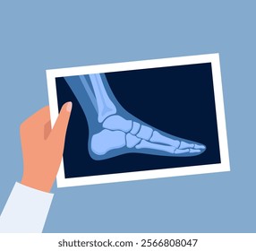 X ray human foot. X-ray picture or radiographic monitor image of metatarsus bones and toes. Medical radiology. Roentgen shot in doctors hand. Vector illustration