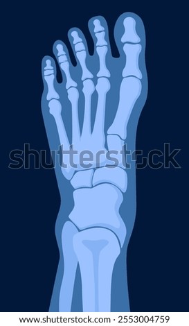 X ray human foot. X-ray picture or radiographic monitor image of metatarsus bones and toes. Medical radiology.