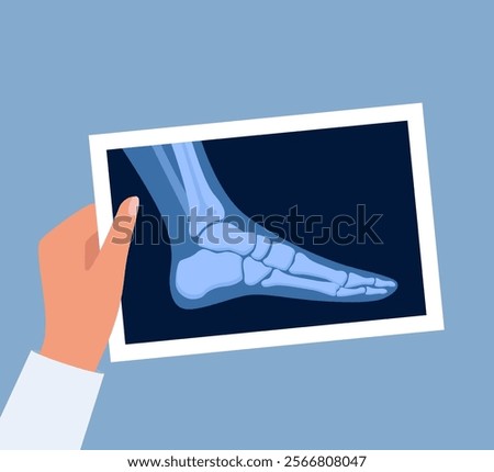 X ray human foot. X-ray picture or radiographic monitor image of metatarsus bones and toes. Medical radiology. Roentgen shot in doctors hand. Vector illustration