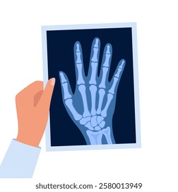 X ray human hand. Body bone roentgen front view. Medical anatomy. Arm checking healthcare joint palm finger exam. Roentgen shot in doctors hand. Vector illustration