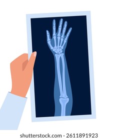 X ray human hand. Body bone roentgen front view. Medical anatomy. Arm checking healthcare joint palm finger exam. Roentgen shot in doctors hand. Vector illustration