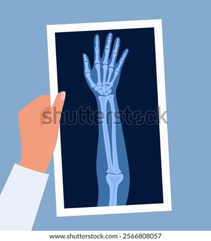 X ray human hand. Body bone roentgen front view. Medical anatomy. Arm checking healthcare joint palm finger exam. Roentgen shot in doctors hand. Vector illustration
