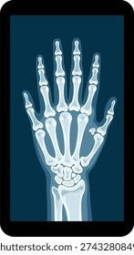 X ray image of human hand bones displayed on digital tablet screen medical visualization