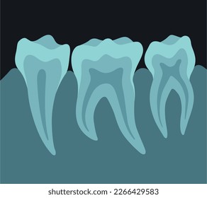 X ray image of teeth dental equipment medical surgery radiogram photo vector flat illustration. Dentist hygiene patient anatomy toothache protection dentistry care health checking test scanner