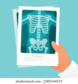 X ray medical roentgen human body skeleton diagnostic image in male doctor hand vector flat illustration. Man physician therapist holding xray picture anatomy bone scan radiology test disease checkup