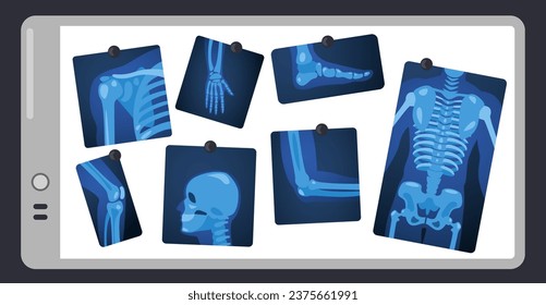 X ray on doctor screen. Human skeleton parts on surgery light pad, body parts medical x-ray concept. Vector illustration. Bone injuries, healthcare. Skull, leg, knee and chest scan pictures