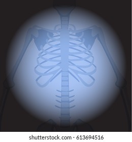 X ray ribs. Human skeleton's part on black background.