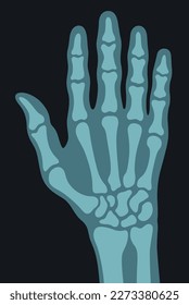 X ray right human hand ultra skeleton body bone roentgen front view vector flat illustration. Medical anatomy arm checking healthcare joint palm finger exam radiology scan MRI hospital traumatology