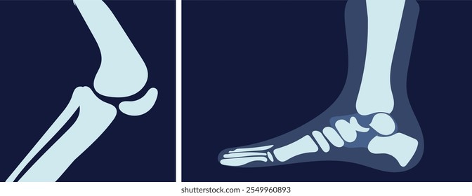 Imagem de raios X com osso. Raio X dos pés e joelho. Diagnóstico e tratamento. Saúde e medicina. Elemento gráfico para site. Ilustração de vetor plano isolada no plano de fundo azul