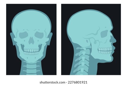 X rays shots of human skull front side view set vector flat illustration. Skeleton bone roentgen medical checkup healthcare science research. Anatomical patient radiology picture head surgery scanning