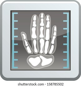 X-Ray
