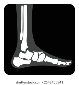 X-ray ankle joint foot. Vector illustration