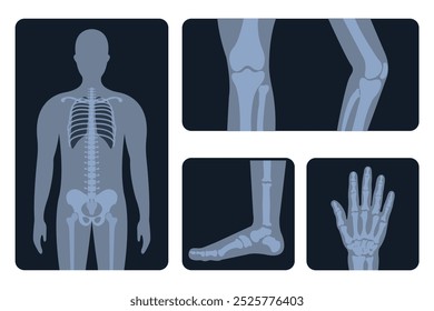 X-ray body parts. Human skeleton, knee, arm, chest, wrist concept, medical radiology imaging of bone injuries. Vector flat set. Hospital examination