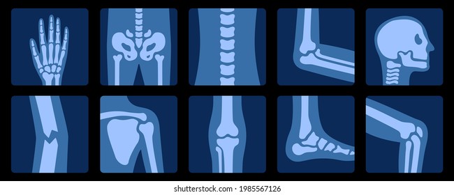 X-ray of bones. X-rays examination of human joint anatomy. Medical, educational and science illustration.