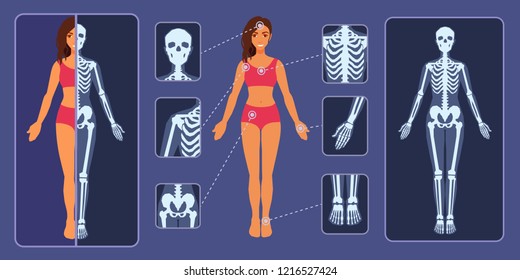 X-ray examination pictures. Image of the bones of the human skeleton. The girl is being examined in the hospital. Vector flat style cartoon illustration.