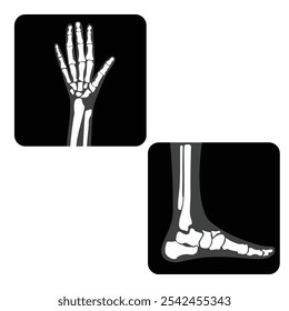 X-ray film ankle joint foot and hand with fingers. Vector illustration