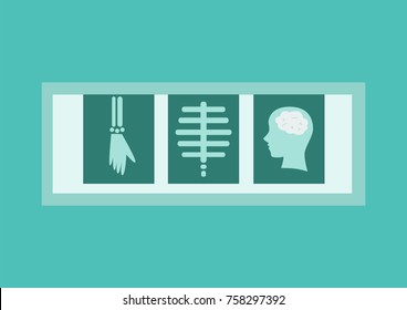 X-ray films in flat style. Vector Illustration