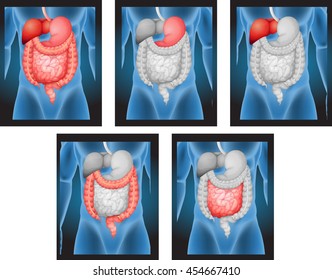 X-ray films of human organs illustration