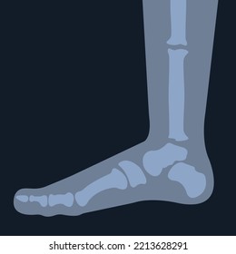 x-ray of the foot skeleton. Human leg bones. Joint anatomy