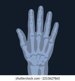X-ray graphic image of the hand. Symptoms of a physical examination of the joints and bones of a person. The concept of a strong skeleton.