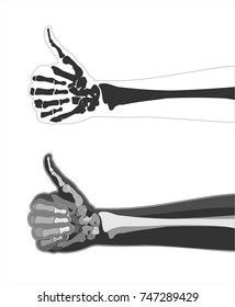 X  ray hand  Hand finger up done in the style X  rays and the image the bones  Vector Image  All elements layers