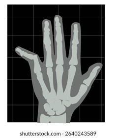  x-ray hand. finger x ray.X ray right human hand ultra skeleton body bone roentgen