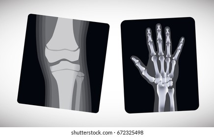 X-ray of the hand and foot. Vector illustration.