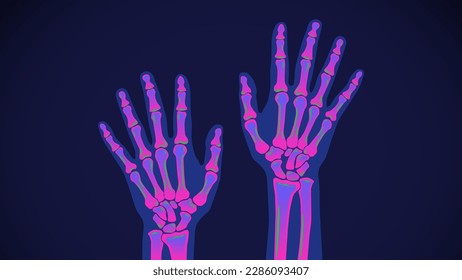 X-RAY hands and wrist bones