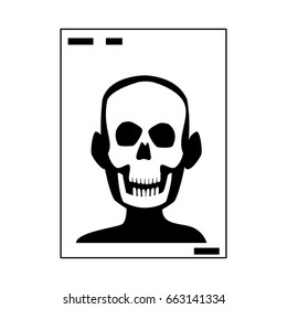 xray of head bone structure of human medical health