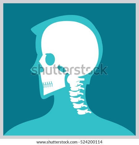 Xray of  head and neck, the joints and bones,human joints, skeletal spinal bone structure of Human Spine, medical health care flat vector illustration.