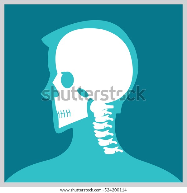 頭と首のx線 関節と骨 人間の関節 ヒトの脊椎の骨格骨構造 医療用フラットベクターイラスト のベクター画像素材 ロイヤリティフリー