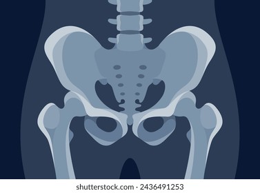 Xray of hip joint pelvis human bones anatomy orthopedic medical diagnostic vector flat illustration. X ray roentgen radiology shot surgery femur healthy skeleton spine anatomical structure image