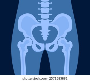 XRay of hip joint pelvis human bones anatomy orthopedic medical diagnostic. X ray roentgen radiology shot surgery femur healthy skeleton spine anatomical structure image. Vector