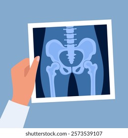 XRay of hip joint pelvis human bones anatomy orthopedic medical diagnostic. Roentgen shot in doctors hand. Vector illustration