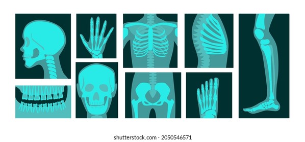 X  ray human body parts vector illustrations set  Bones skeleton  roentgen head  chest  hand  leg  knee  foot radiographs isolated white background  Anatomy  medicine  health concept