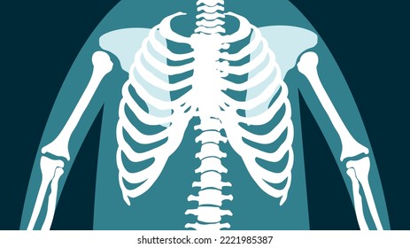 X-ray of the human chest