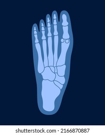 X-ray of human foot bones. Human joint anatomy x-rays vector illustration.