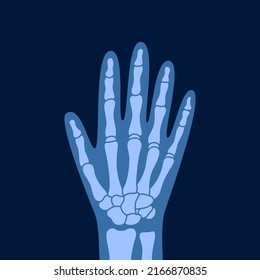 X-ray of human hand bones. Human joint anatomy x-rays vector illustration.