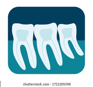 X-ray of human teeth. Three healthy molars on an x-ray. Vector illustration