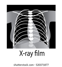 An x-ray of human thorax, chest. medical icon vector.