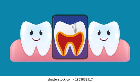 X-ray of human tooth with characters. Smiling teeth on gum. Vector cartoon style.