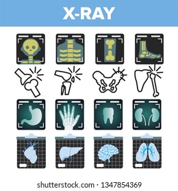 X-ray Icon Set Vector. Radiology Scan. Broken Human Bone. Medical Symbol. Fracture Structure. Health Hospital Medicine Design. Line, Flat Illustration
