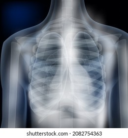 X-Ray Image Of Human Chest Medical Diagnosis. EPS10 Vector