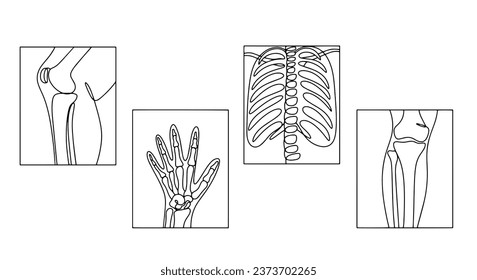 X  ray image