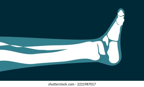 X-ray image of the leg on a black background