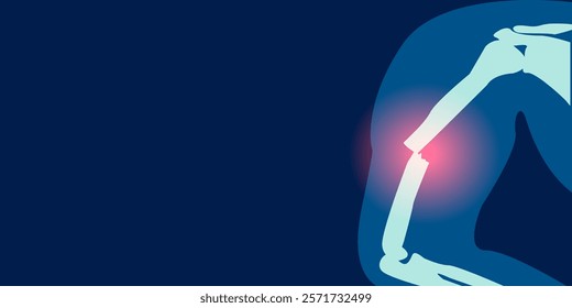 X-ray image of upper arm fracture illustration design. 2D rontgen illustration of upper arm fracture. Vector illustration.