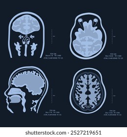 Imágenes de rayos X del cerebro, escaneadas con resonancia magnética o tomografía computarizada. Aceptar radiología